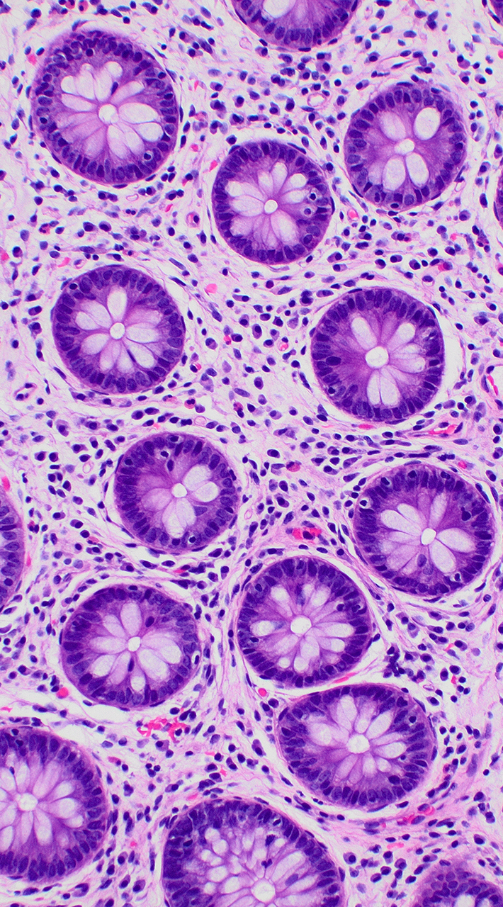 Cells shown under a microscope