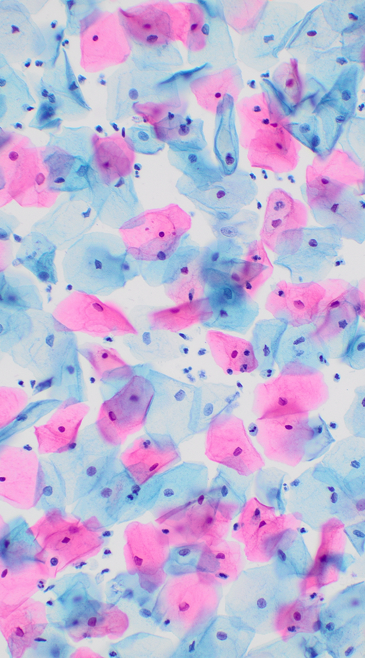 Image of a slide containing a thin layer of cells stained with a special dye to highlight different cellular components.