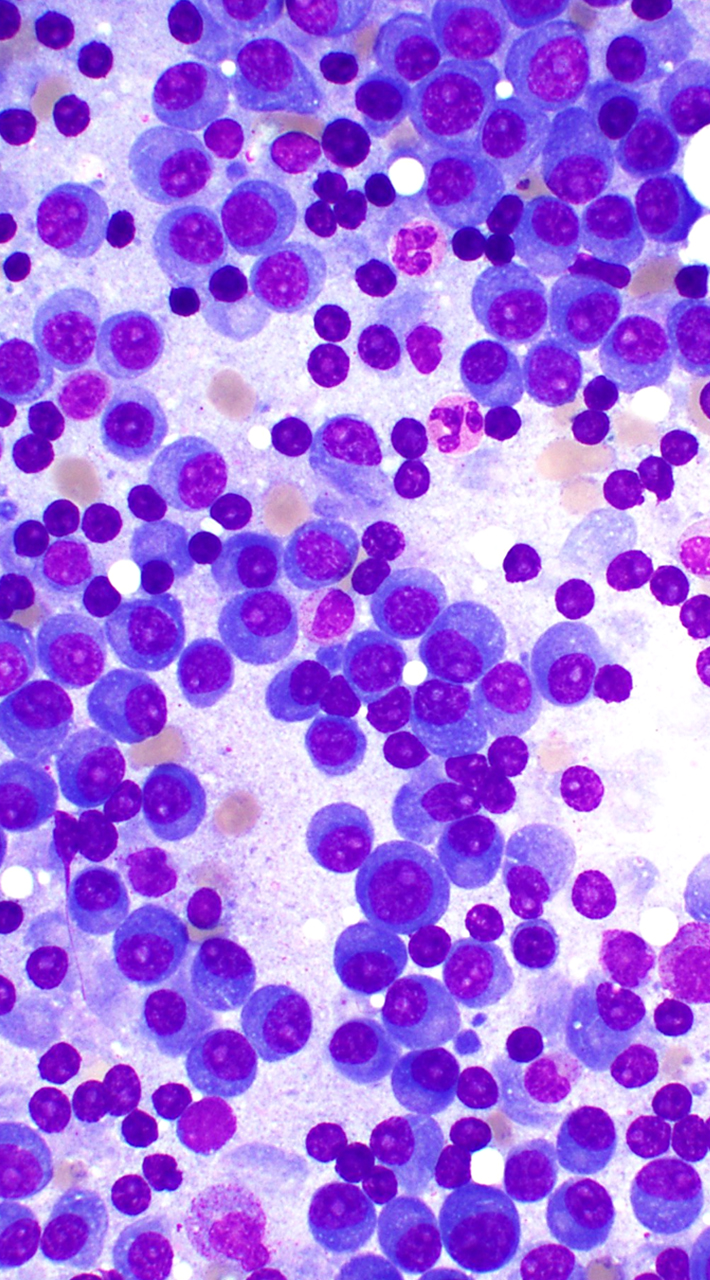 Image shows a slide smeared with different types of blood cells.