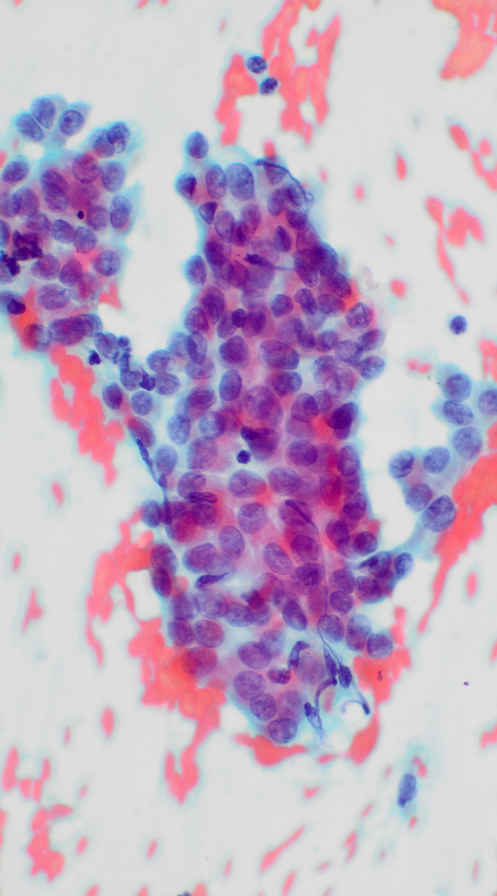 A microscopic image of a stained smear from a non-gynecological site.