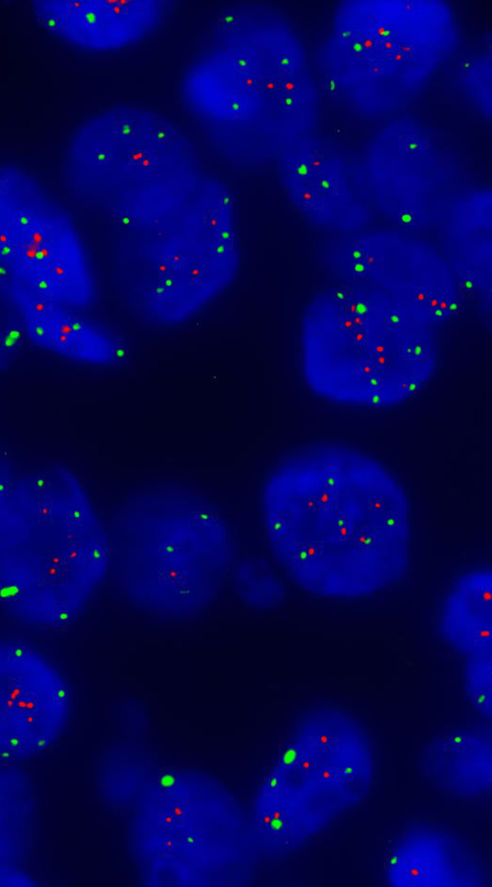 Microscopic image of cells that have been treated with fluorescently labeled DNA sequences.